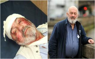 David Amos on his way to hospital in Nablus shortly after the attack, and back at home in Barnes